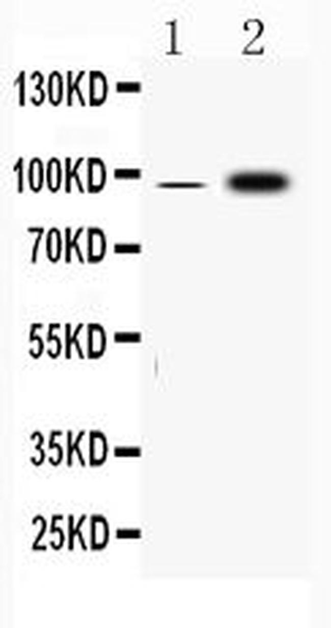 Fibrinogen alpha chain Antibody in Western Blot (WB)