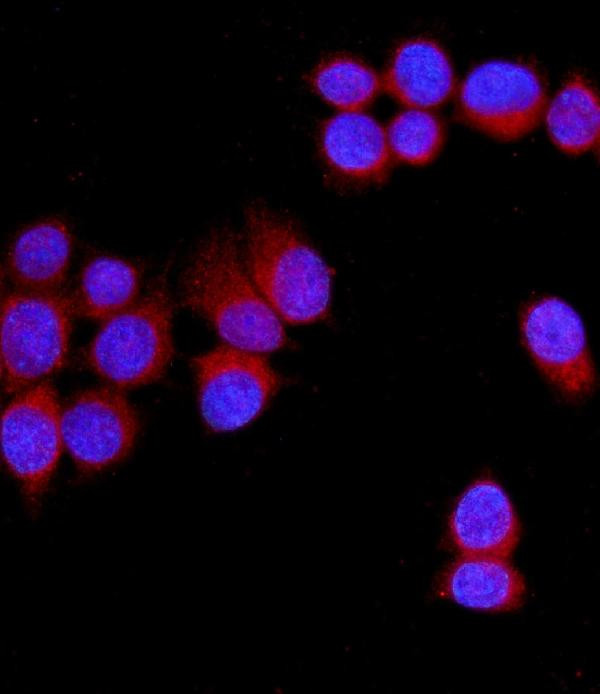 SLC11A1 Antibody in Immunocytochemistry (ICC/IF)