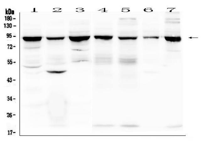 RNF169 Antibody in Western Blot (WB)