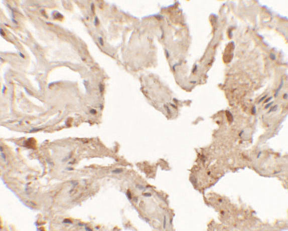 Nkx2.1 Antibody in Immunohistochemistry (Paraffin) (IHC (P))