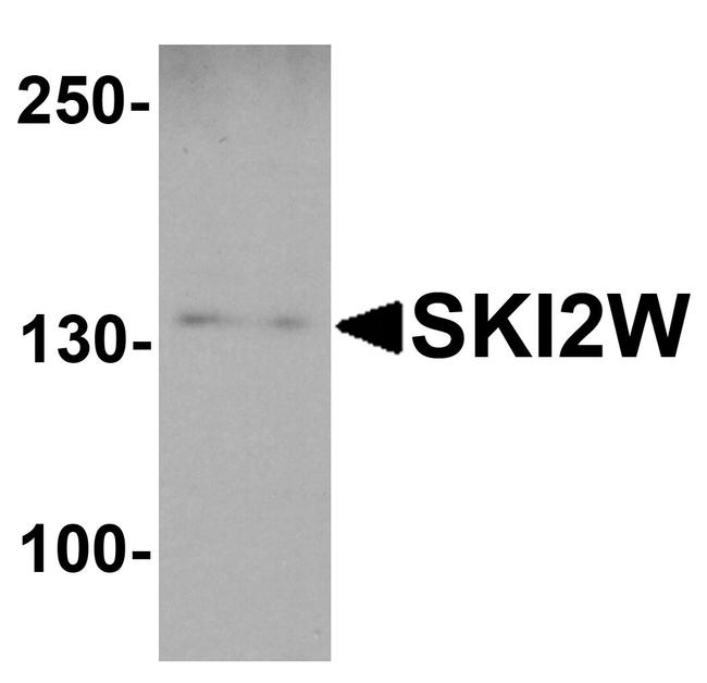 SKIV2L Antibody in Western Blot (WB)