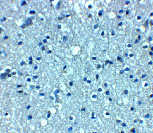 VTI1A Antibody in Immunohistochemistry (Paraffin) (IHC (P))