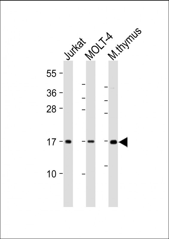 CD3z Antibody in Western Blot (WB)