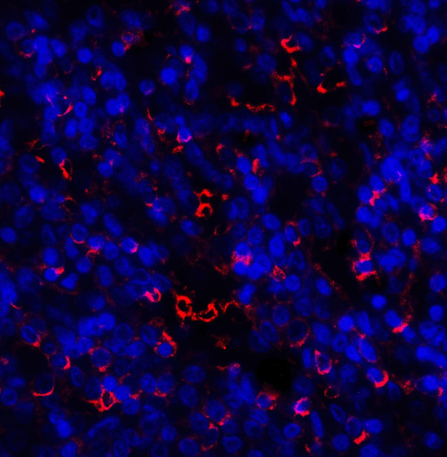 TIM-3 Antibody in Immunohistochemistry (Paraffin) (IHC (P))