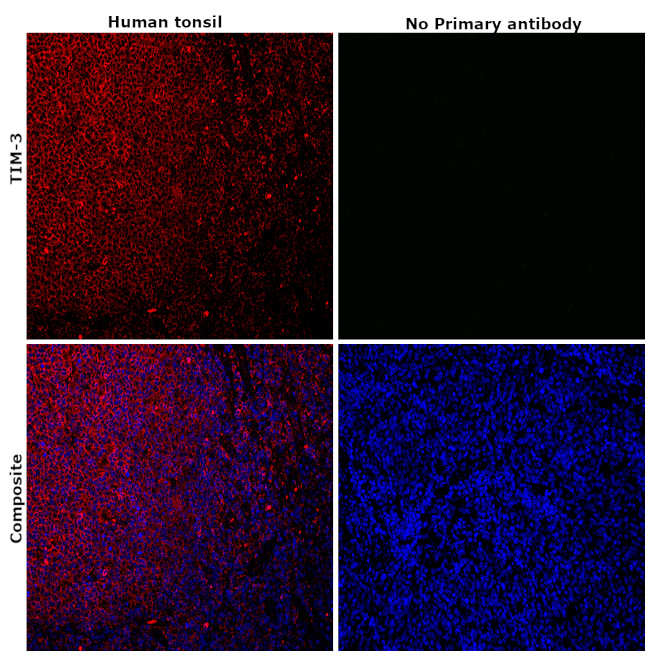 TIM-3 Antibody in Immunohistochemistry (Paraffin) (IHC (P))