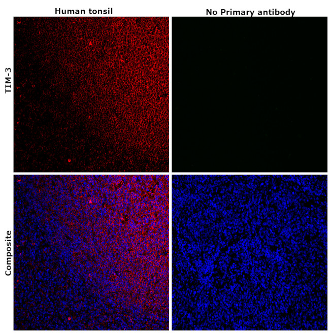 TIM-3 Antibody in Immunohistochemistry (Paraffin) (IHC (P))