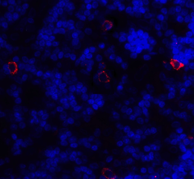 CD86 Antibody in Immunohistochemistry (Paraffin) (IHC (P))