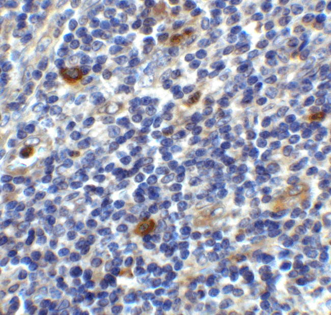 CD86 Antibody in Immunohistochemistry (Paraffin) (IHC (P))