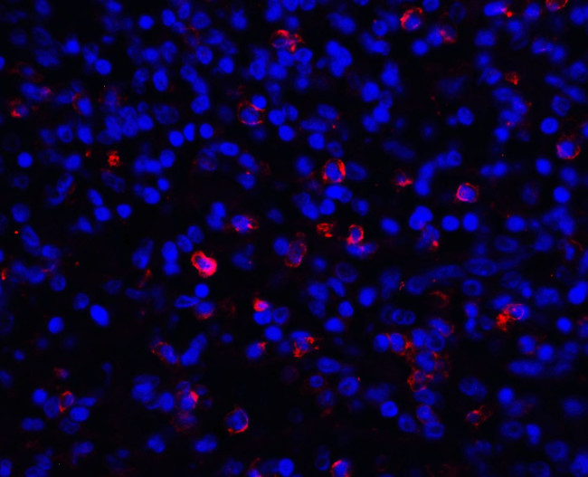 B7-H3 (CD276) Antibody in Immunohistochemistry (Paraffin) (IHC (P))