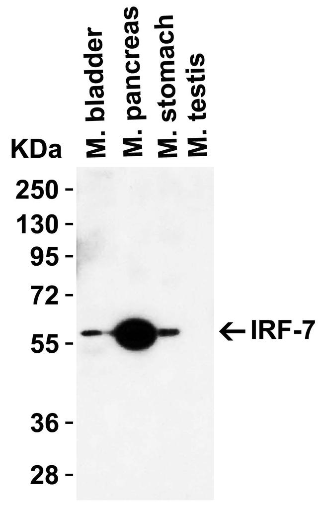 IRF7 Antibody in Western Blot (WB)