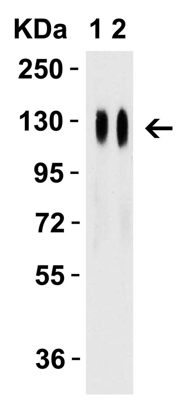SARS-CoV-2 Spike Protein (RBD) Antibody in Western Blot (WB)