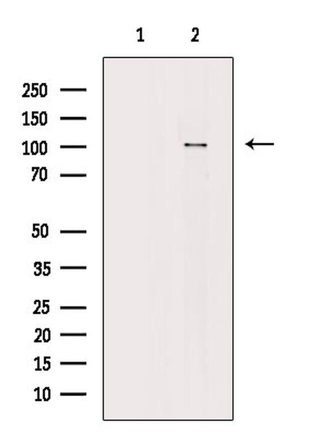 Phospho-alpha Actinin 1/2/3/4 (Ser159) Antibody in Western Blot (WB)