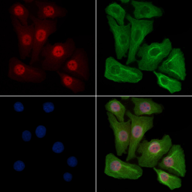 Phospho-Progesterone Receptor (Ser190) Antibody in Immunocytochemistry (ICC/IF)