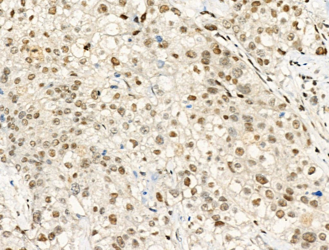 Phospho-Progesterone Receptor (Ser190) Antibody in Immunohistochemistry (Paraffin) (IHC (P))