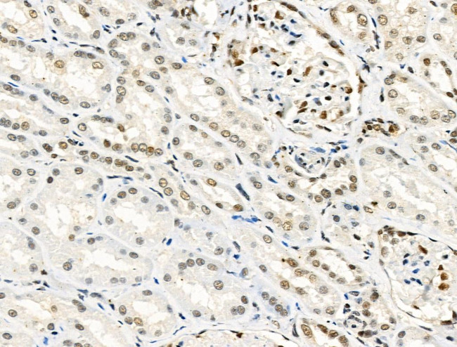 Phospho-Progesterone Receptor (Ser190) Antibody in Immunohistochemistry (Paraffin) (IHC (P))