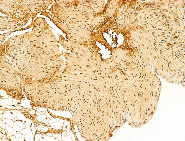 Phospho-RB1 (Ser780) Antibody in Immunohistochemistry (Paraffin) (IHC (P))