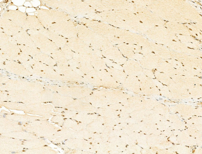 Phospho-RB1 (Ser780) Antibody in Immunohistochemistry (Paraffin) (IHC (P))