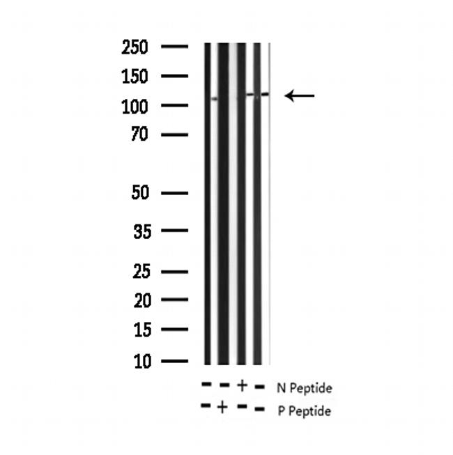 Phospho-RB1 (Ser780) Antibody in Western Blot (WB)
