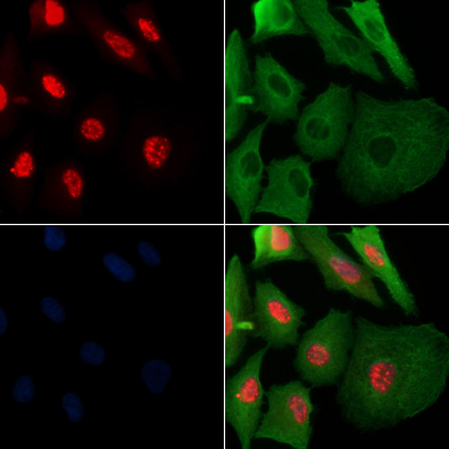 Phospho-SAMHD1 (Thr592) Antibody in Immunocytochemistry (ICC/IF)