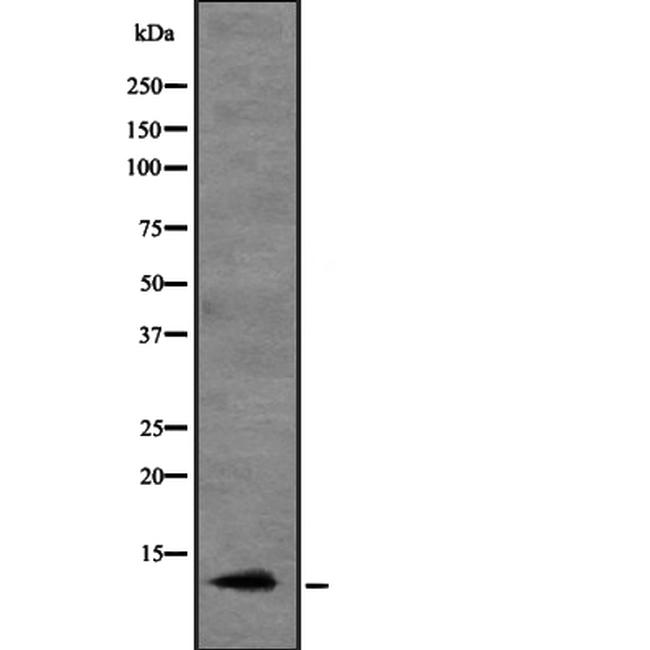 MIP-3 alpha Antibody in Western Blot (WB)