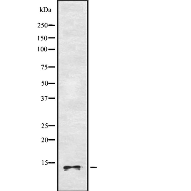 CYP3A43 Antibody in Western Blot (WB)