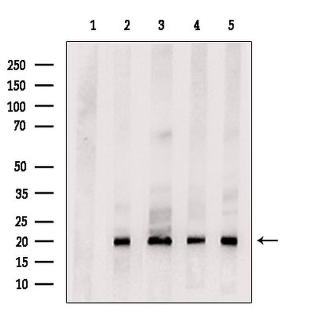 FGF8 Antibody in Western Blot (WB)
