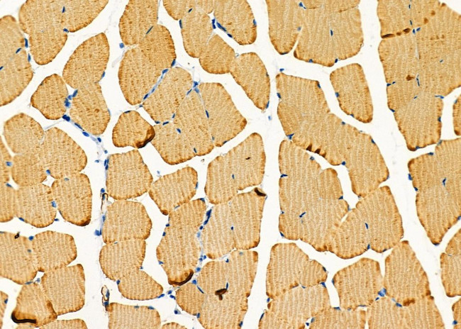 GPR64 Antibody in Immunohistochemistry (Paraffin) (IHC (P))