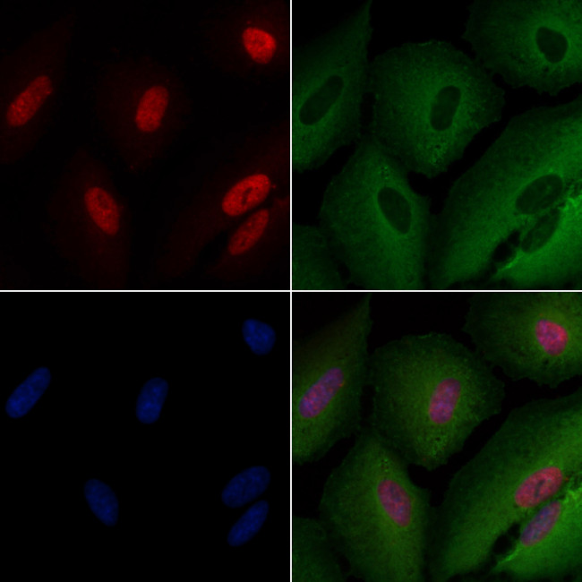 MSH3 Antibody in Immunocytochemistry (ICC/IF)