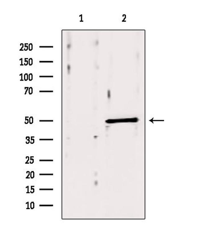 ACOX1 Antibody in Western Blot (WB)