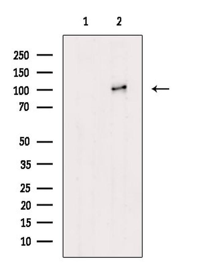 alpha Actinin 1/2/3/4 Antibody in Western Blot (WB)