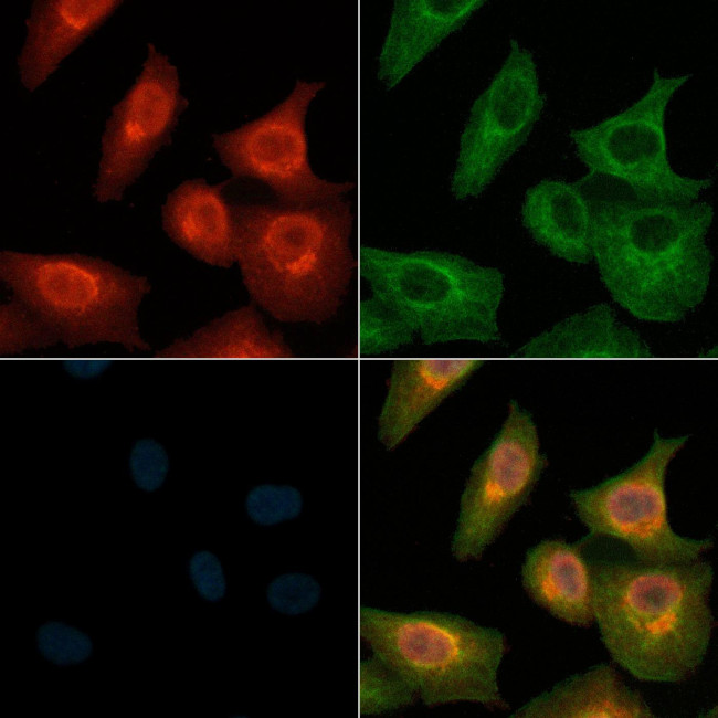 APLF Antibody in Immunocytochemistry (ICC/IF)