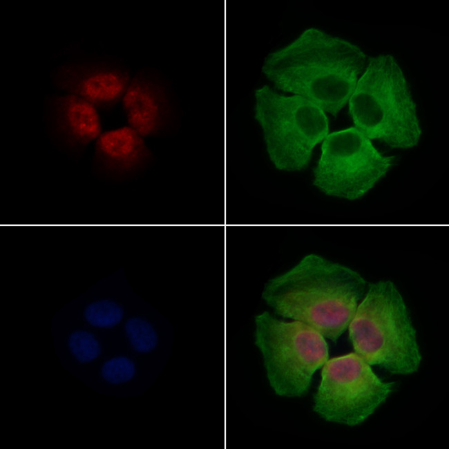 HP1 beta Antibody in Immunocytochemistry (ICC/IF)