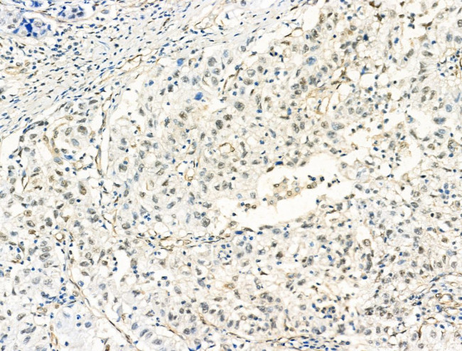 HP1 beta Antibody in Immunohistochemistry (Paraffin) (IHC (P))