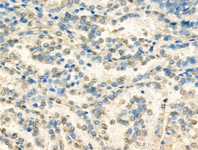 HP1 beta Antibody in Immunohistochemistry (Paraffin) (IHC (P))