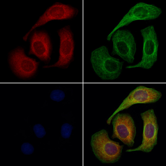 CD47 Antibody in Immunocytochemistry (ICC/IF)