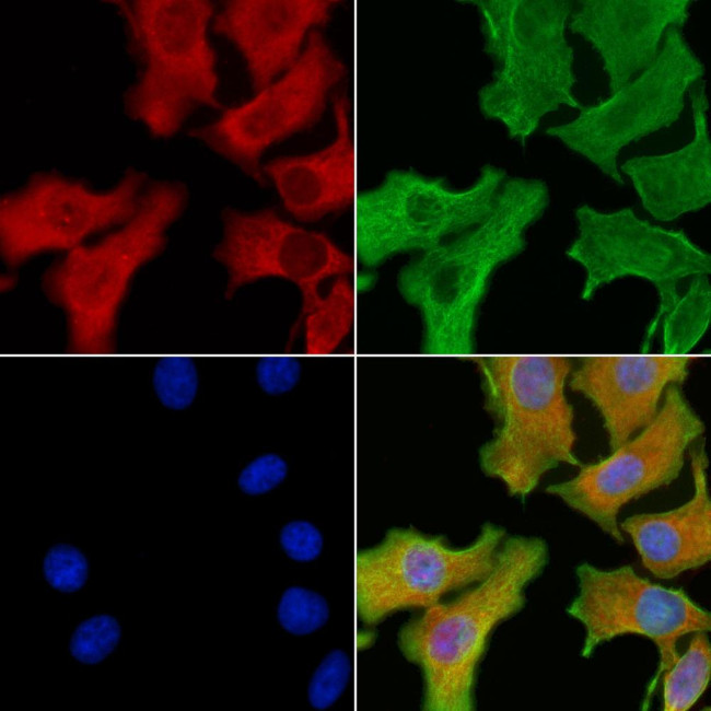 CD47 Antibody in Immunocytochemistry (ICC/IF)