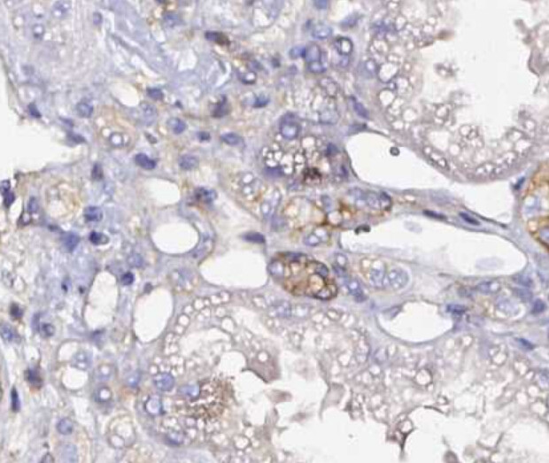 CD47 Antibody in Immunohistochemistry (Paraffin) (IHC (P))