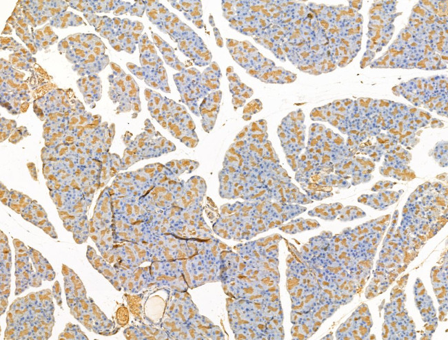 CLPB Antibody in Immunohistochemistry (Paraffin) (IHC (P))