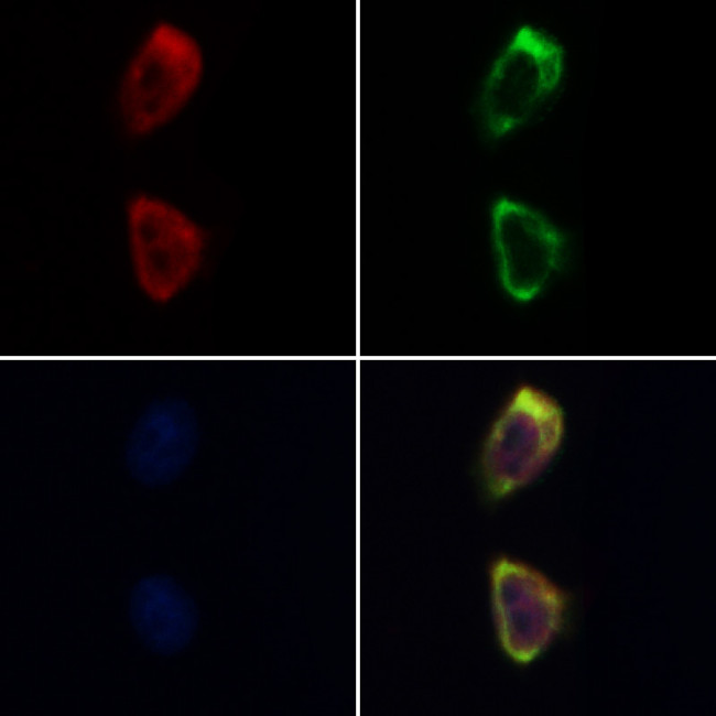 Cofilin 1/2 Antibody in Immunocytochemistry (ICC/IF)