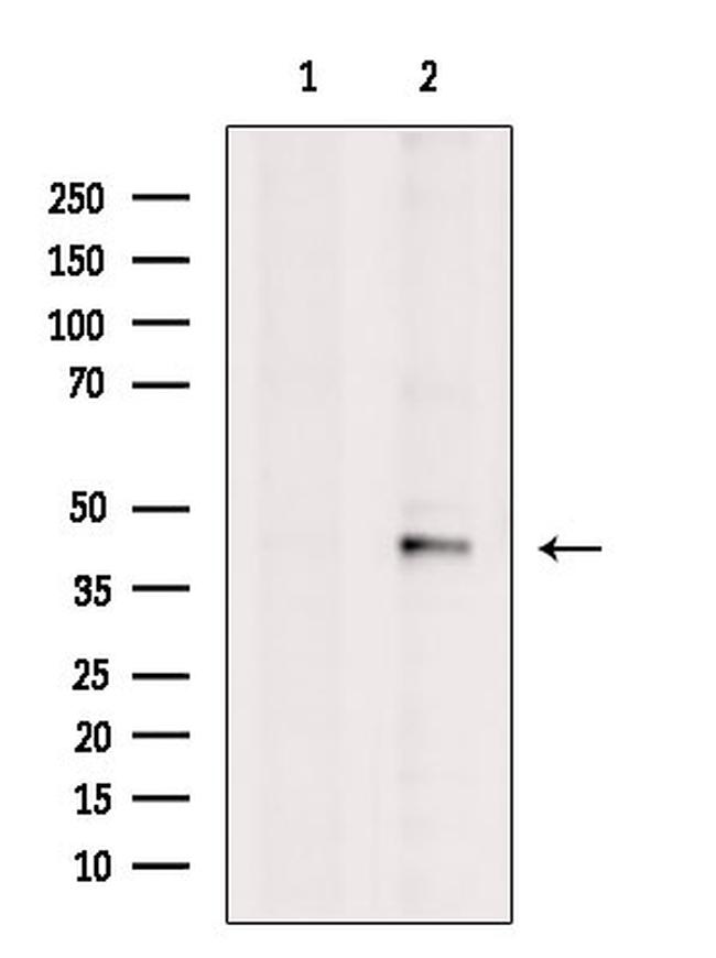 CXCL16 Antibody in Western Blot (WB)