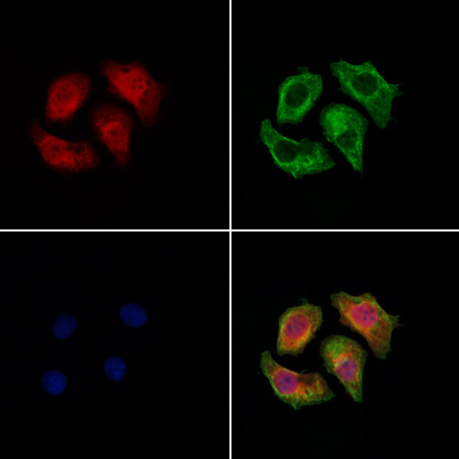 Dectin 1 Antibody in Immunocytochemistry (ICC/IF)