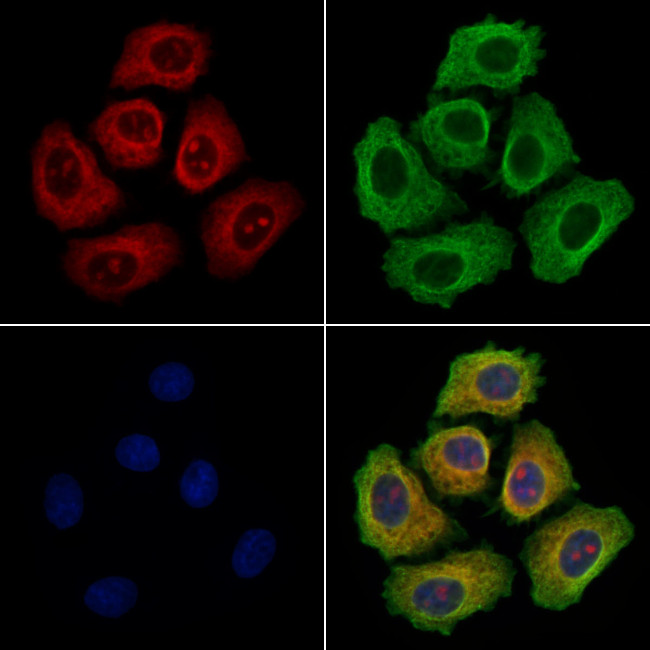 DERL2 Antibody in Immunocytochemistry (ICC/IF)