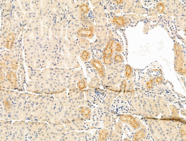 DERL2 Antibody in Immunohistochemistry (Paraffin) (IHC (P))