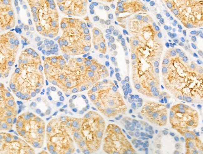 DGAT1 Antibody in Immunohistochemistry (Paraffin) (IHC (P))