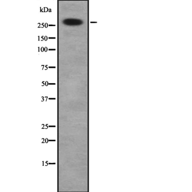 Desmoplakin Antibody in Western Blot (WB)