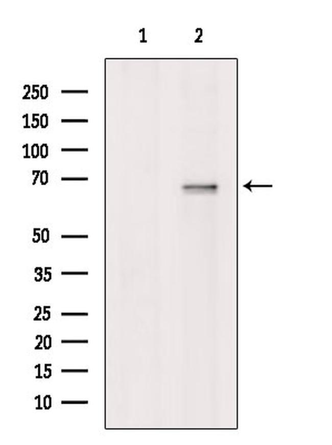 DTX4 Antibody in Western Blot (WB)