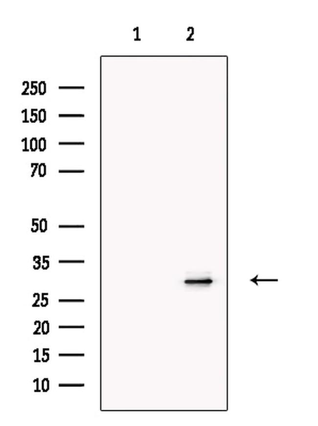 Prodynorphin Antibody in Western Blot (WB)