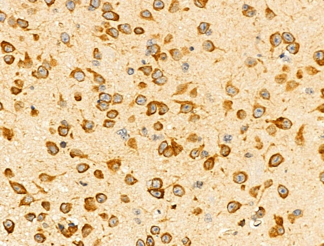 EphA7 Antibody in Immunohistochemistry (Paraffin) (IHC (P))