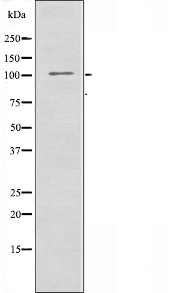 EphA7 Antibody in Western Blot (WB)