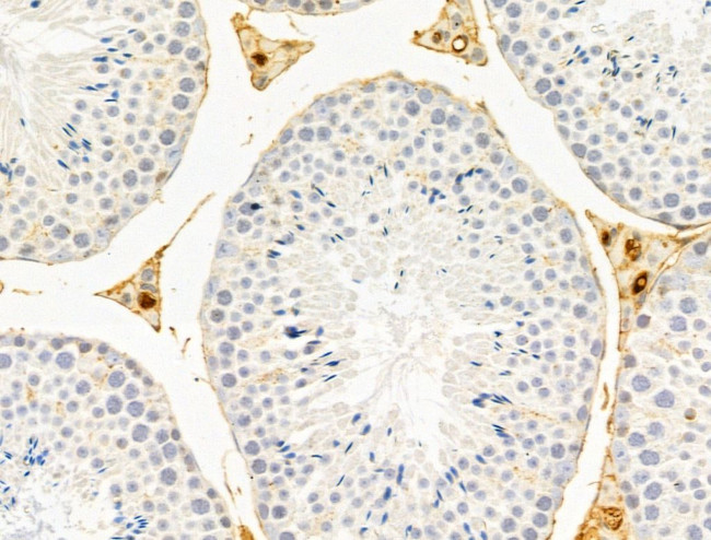 FUCA1 Antibody in Immunohistochemistry (Paraffin) (IHC (P))